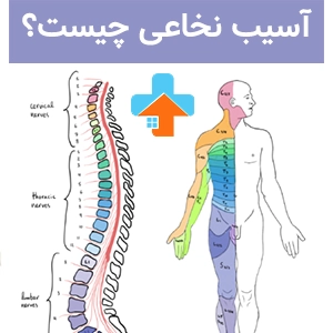 آسیب نخاعی و اختلال در عملکرد حسی و حرکتی | علل و درمان‌های موثر